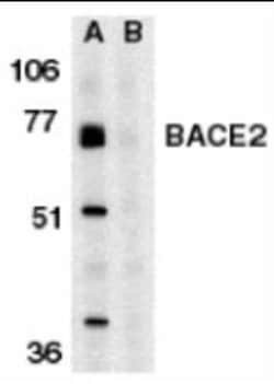Novus Biologicals™ BACE-2 Antibody Blocking Peptide