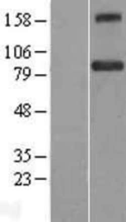 Novus Biologicals™ BACH1 Overexpression Lysate