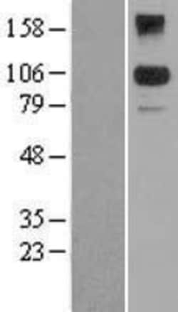 Novus Biologicals&trade;&nbsp;BACH2 Overexpression Lysate