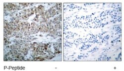 Bad, p Ser112 Antibody, Novus Biologicals:Antibodies:Primary Antibodies