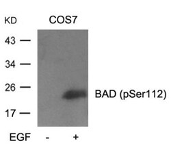Bad, p Ser112 Antibody, Novus Biologicals:Antibodies:Primary Antibodies