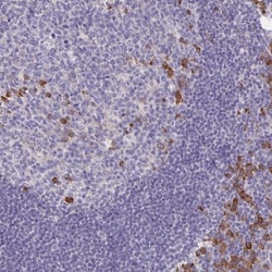 Bad Antibody, Novus Biologicals 0.1mL; Unlabeled:Antibodies, Polyclonal
