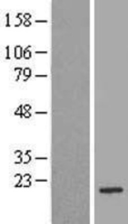Novus Biologicals&trade;&nbsp;Bad Overexpression Lysate