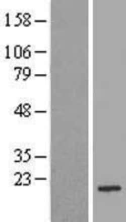 Novus Biologicals&trade;&nbsp;Bad Overexpression Lysate