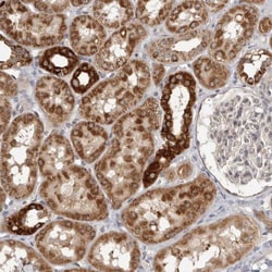 Bad Antibody, Novus Biologicals 0.1mL; Unlabeled:Antibodies, Polyclonal
