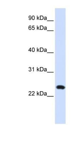 BAD-LAMP/LAMP5 Antibody, Novus Biologicals 100&mu;L; Unlabeled:Antibodies,
