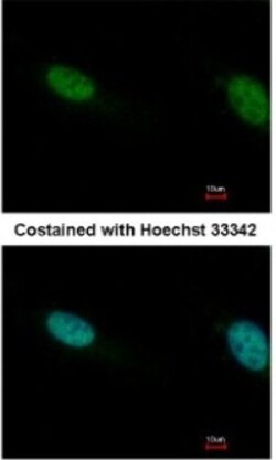 BAF180/PB1 Antibody, Novus Biologicals 0.1mg; Unlabeled:Antibodies, Polyclonal