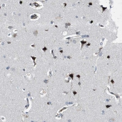 BAF180/PB1 Antibody, Novus Biologicals:Antibodies:Primary Antibodies