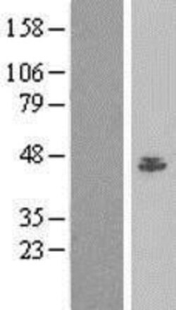 Novus Biologicals™ BAF53A Overexpression Lysate