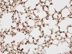 BAF57 Antibody, Novus Biologicals 0.1mg; Unlabeled:Antibodies, Polyclonal