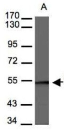 BAF57 Antibody, Novus Biologicals 0.1mg; Unlabeled:Antibodies, Polyclonal