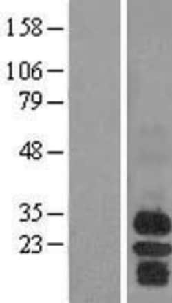 Novus Biologicals™ BAFFR/TNFRSF13C Overexpression Lysate