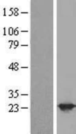 Novus Biologicals&trade;&nbsp;BAG2 Overexpression Lysate
