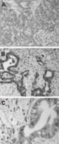 BAG3 Antibody, Novus Biologicals 0.025mL; Unlabeled:Antibodies, Polyclonal