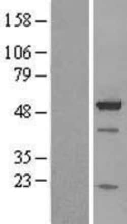 Novus Biologicals&trade;&nbsp;BAG5 Overexpression Lysate
