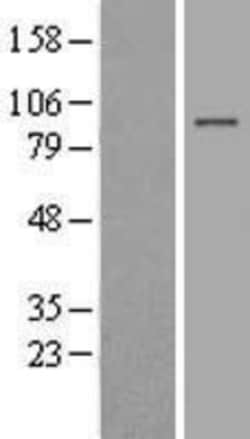 Novus Biologicals™ BAHD1 Overexpression Lysate