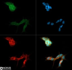 BAI1 Antibody, Novus Biologicals:Antibodies:Primary Antibodies