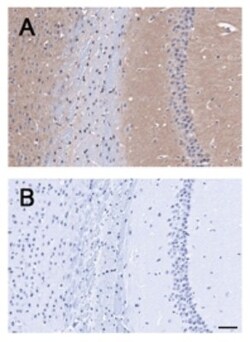 BAI1 Antibody, Novus Biologicals:Antibodies:Primary Antibodies