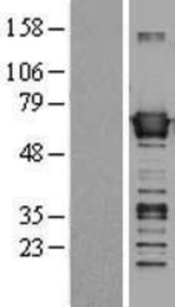 Novus Biologicals™ BAIAP2 Overexpression Lysate