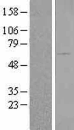 Novus Biologicals&trade;&nbsp;BAIAP2 Overexpression Lysate