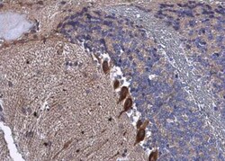 BAIAP2 Antibody, Novus Biologicals 0.1mL; Unlabeled:Antibodies, Polyclonal