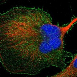 BAIAP2L1 Antibody, Novus Biologicals 25 &mu;L | Buy Online | Novus Biologicals | Fisher Scientific