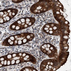 BAIAP2L1 Antibody, Novus Biologicals 25 &mu;L; Unlabeled:Antibodies, Polyclonal