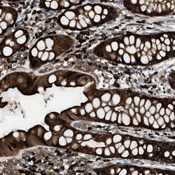 BAIAP2L1 Antibody, Novus Biologicals 0.1mL; Unlabeled:Antibodies, Polyclonal