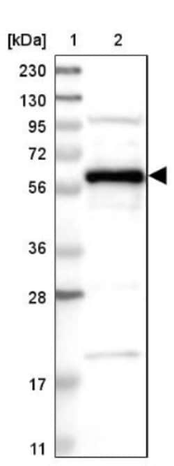 BAIAP2L1 Antibody, Novus Biologicals 0.1mL; Unlabeled:Antibodies, Polyclonal