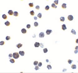 BAK Antibody, Novus Biologicals 0.1mg; Unlabeled:Antibodies, Polyclonal