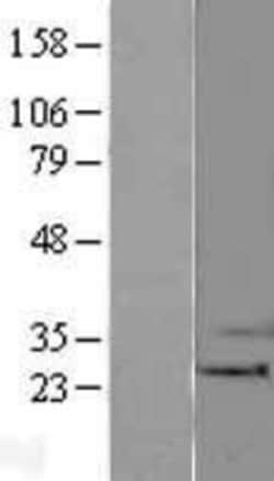 Novus Biologicals™ BAK Overexpression Lysate