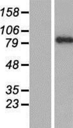 Novus Biologicals BAL/PARP9 Overexpression Lysate 0,1 mg | Buy Online | Novus Biologicals&trade; | Fisher Scientific