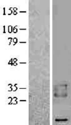 Novus Biologicals™ BAMBI/NMA Overexpression Lysate
