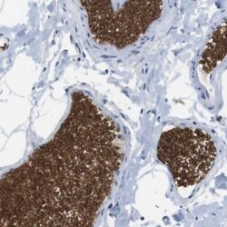 Band 3 Antibody, Novus Biologicals 0.1mL; Unlabeled:Antibodies, Polyclonal