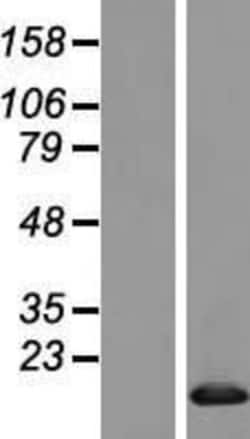 Novus Biologicals&trade;&nbsp;BANF2 Overexpression Lysate