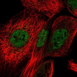 BANF2 Antibody, Novus Biologicals 0.1mL; Unlabeled:Antibodies, Polyclonal