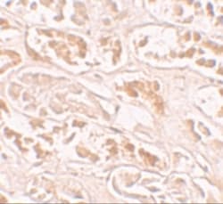 BANP Antibody - BSA Free, Novus Biologicals 0.1mg; Unlabeled:Antibodies,