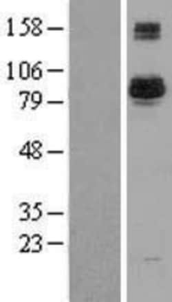 Novus Biologicals&trade;&nbsp;BAP1 Overexpression Lysate