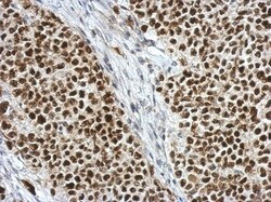 BAP18 Antibody, Novus Biologicals 0.1mL; Unlabeled:Antibodies, Polyclonal