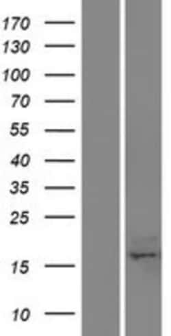 Novus Biologicals&trade;&nbsp;BAP18 Overexpression Lysate