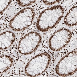 BAP18 Antibody, Novus Biologicals 0.1mL; Unlabeled:Antibodies, Polyclonal