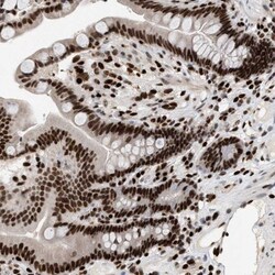 BAP18 Antibody, Novus Biologicals 0.1mL; Unlabeled:Antibodies, Polyclonal