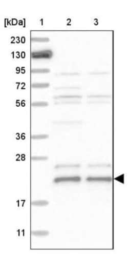 BAP18 Antibody, Novus Biologicals 0.1mL; Unlabeled:Antibodies, Polyclonal