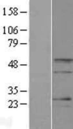 Novus Biologicals&trade;&nbsp;BARHL2 Overexpression Lysate