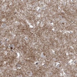 Bassoon Antibody, Novus Biologicals 0.1mL; Unlabeled:Antibodies, Polyclonal