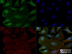 anti-Bax inhibitor 1, Clone: 20F248, Novus Biologicals 0.2mL; Unlabeled:Antibodies,