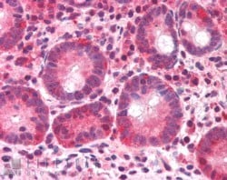 BAZ2B Antibody, Novus Biologicals 0.1mg; Unlabeled:Antibodies, Polyclonal