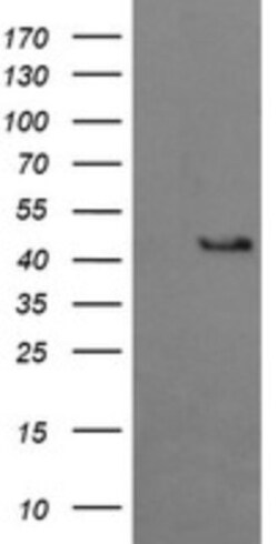 BBOX1 Antibody (OTI4F9), Novus Biologicals 0.1mL; Unlabeled:Antibodies,