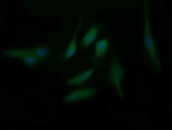 BBOX1 Antibody (OTI4F9), Novus Biologicals 0.1mL; Unlabeled:Antibodies,