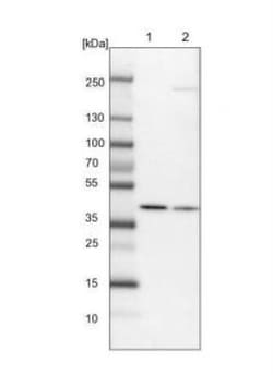 BBOX1 Antibody, Novus Biologicals:Antibodies:Primary Antibodies